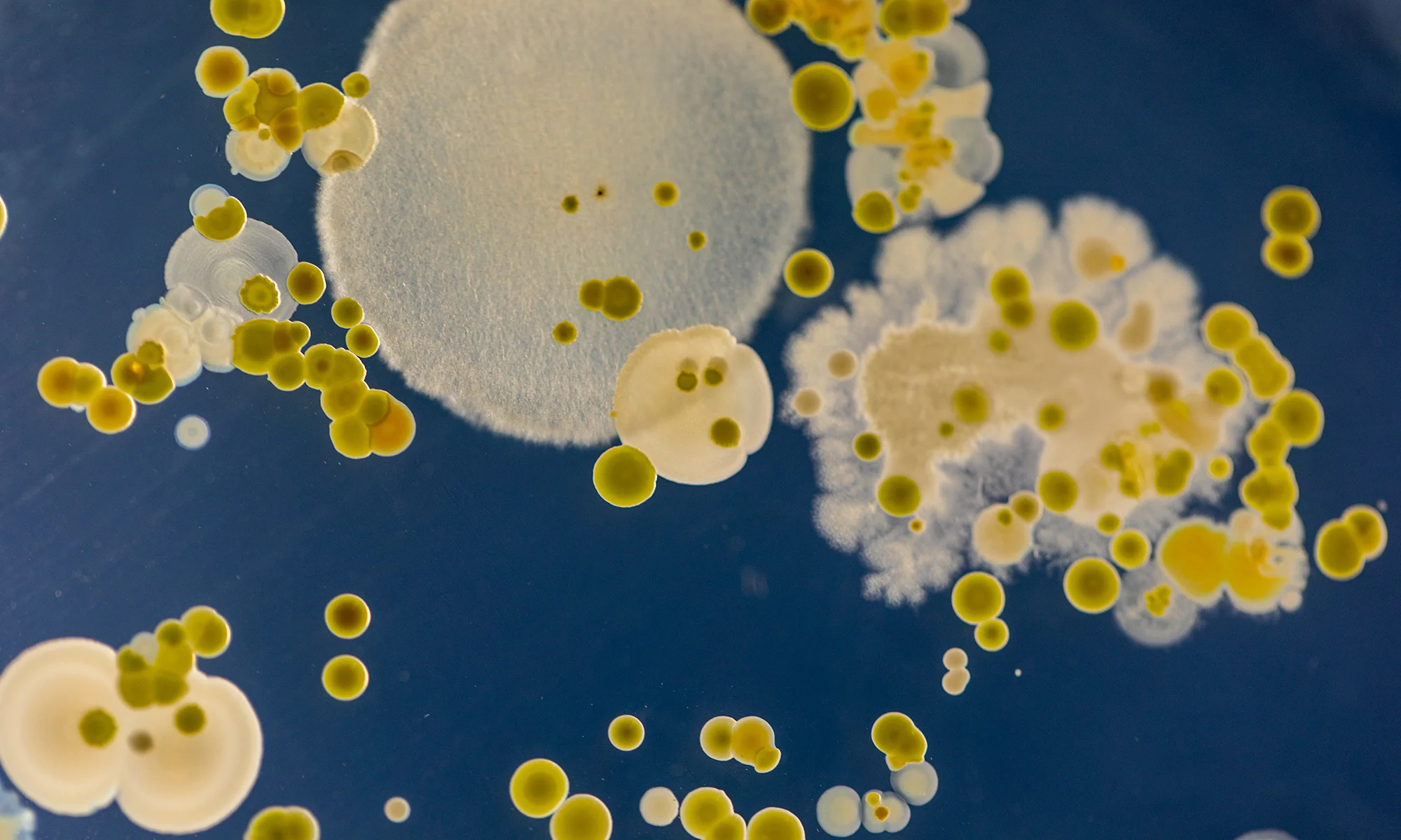 Macro shot of microscopic pathogens and infectious disease research
