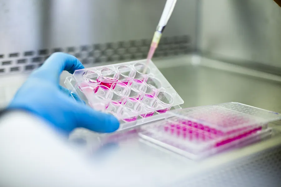 A gloved hand holds a laboratory multiwell plate containing pink liquid researching COVID's relationship to Alzheimer's disease