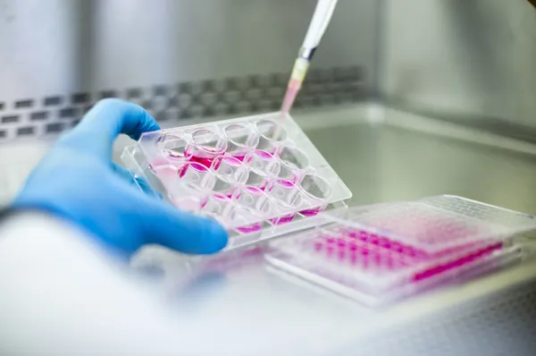 PCOM Study Links COVID-19 and Bacterial Infection to Alzheimer's Disease