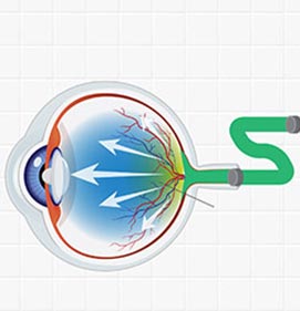 Infographic showing how Myo/Nog cells help protect eyes.